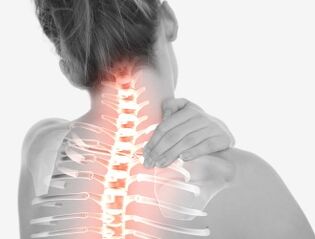 Cervical eskualdeko osteokondrosia
