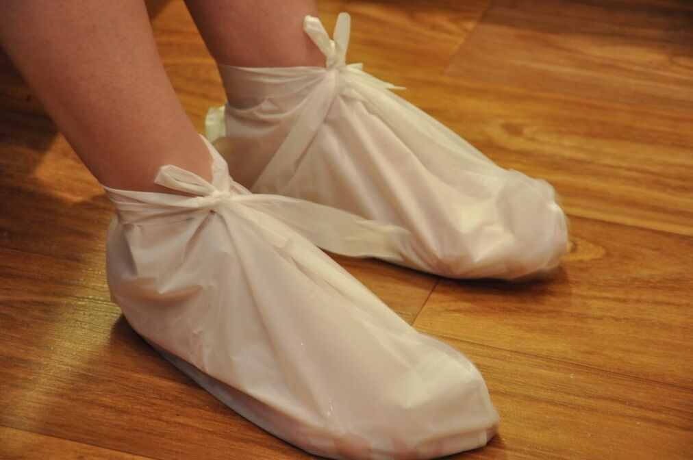 orkatila artrosirako konpresak