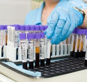odol azterketa artikulazioetako mina diagnostikatzeko