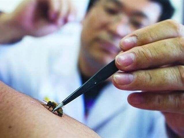 Trápaga osteokondrosiaren apiterapia